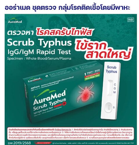 ชุดตรวจออร่าเมด - สครับไทฟัส (ไข้รากสาดใหญ่) IgG/IgM