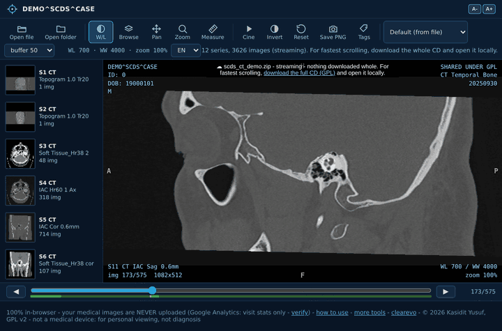 ClearEvo DICOM Viewer - scrolling through a CT scan in the browser