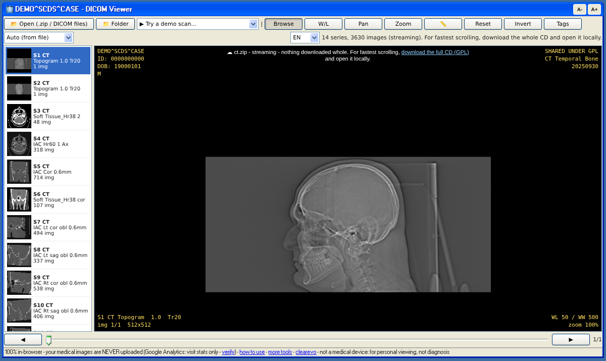 DICOM viewer online - CT scan CD streamed in the browser